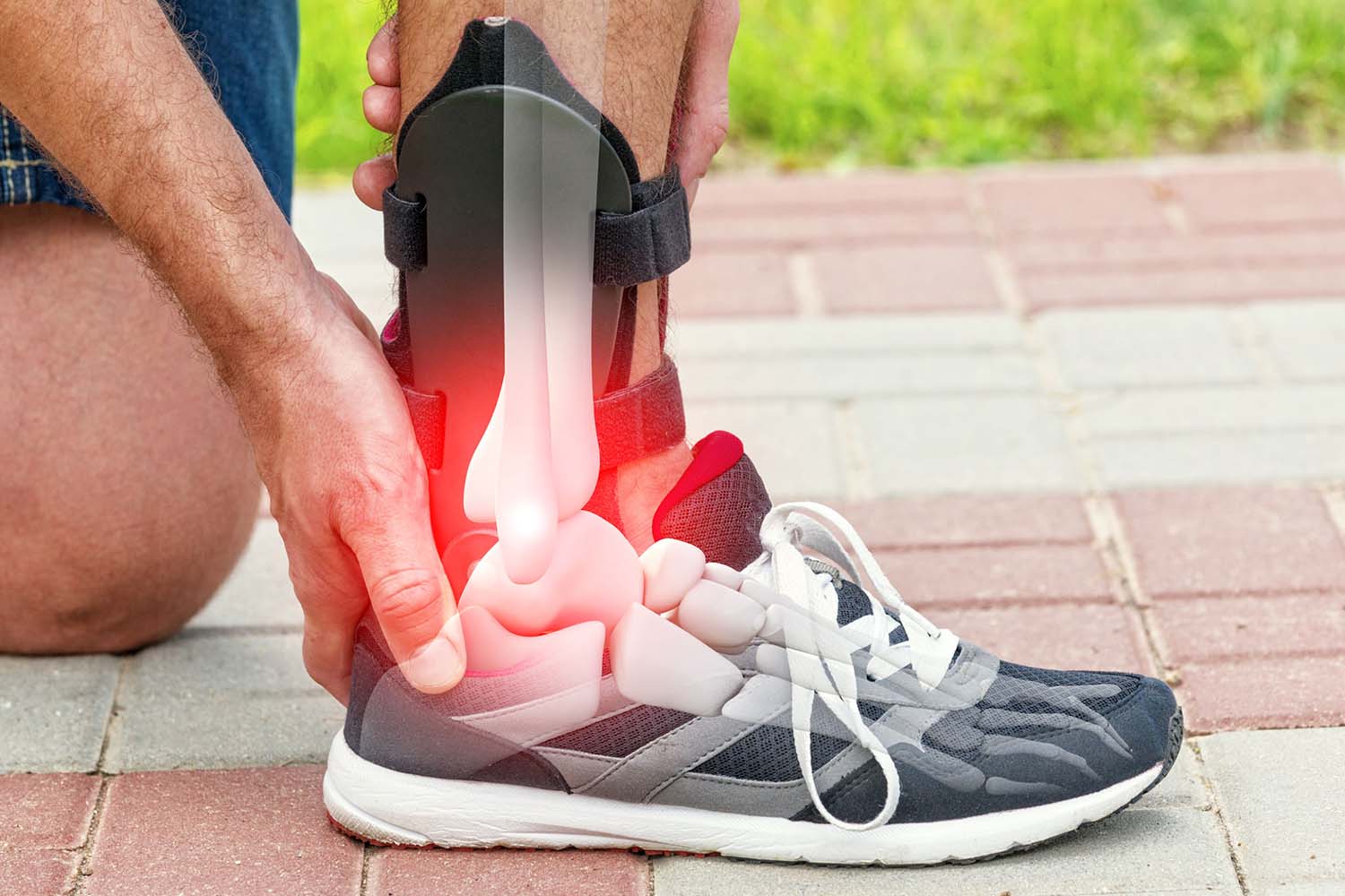 Ankle Foot Orthosis (AFO)