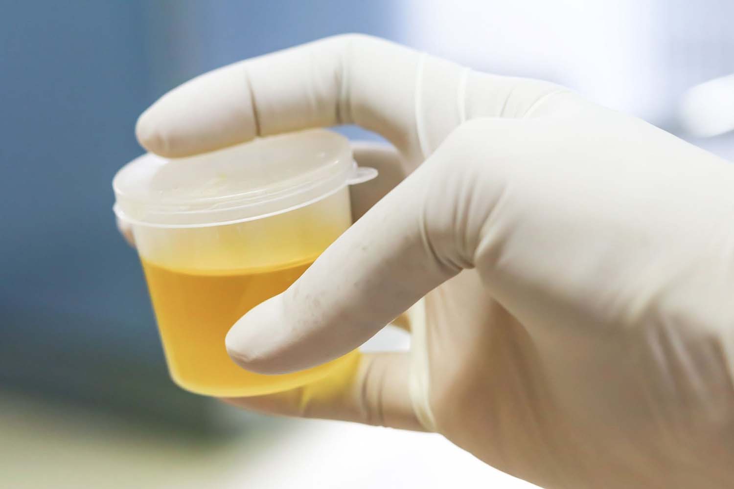 Best Synthetic Urine Kits: Top 5 Fake Pee Brands To Pass a Drug Test