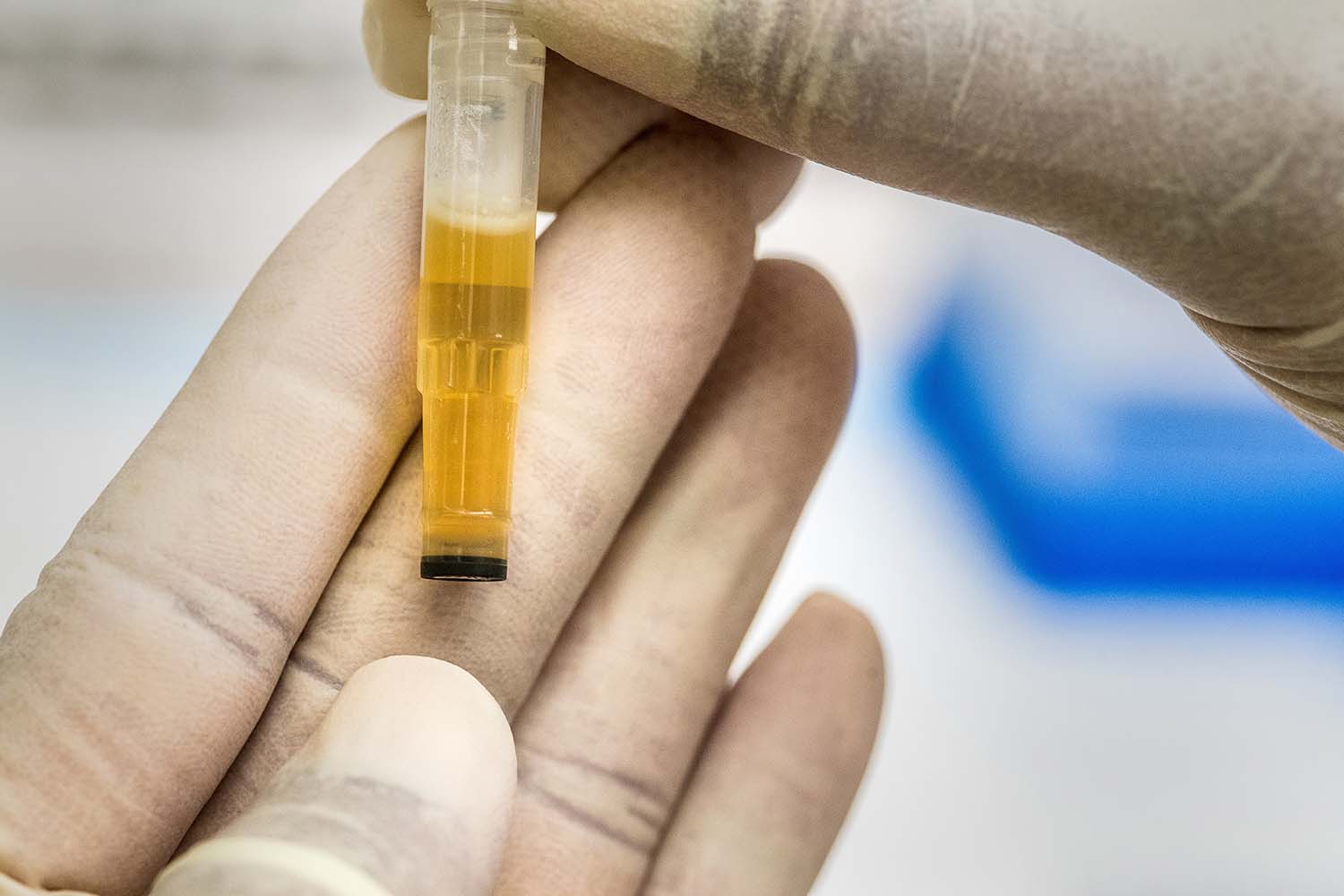Best Synthetic Urine Kits: Top Brands for Passing a Drug Test